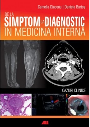 De la simptom la diagnostic in medicina interna