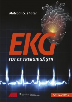 EKG - Tot ce trebuie sa stii