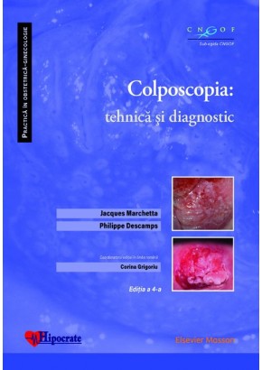 Colposcopia: tehnica si diagnostic (Practica in Obstetrica-Ginecologie)