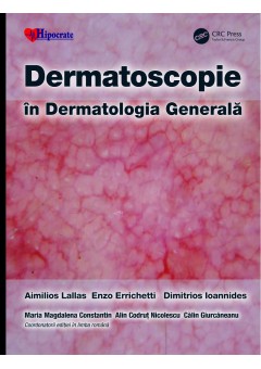 Dermatoscopie in Dermatologia Generala